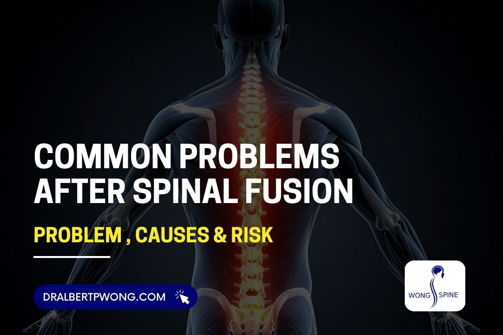 Common Problems After Spinal Fusion