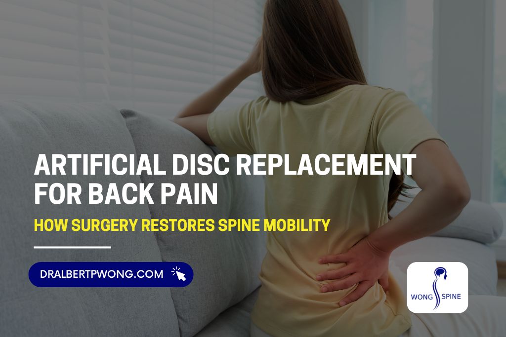 Artificial Disc Replacement for Back Pain: See How It Can Help