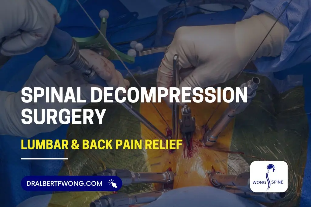 Spinal Decompression Surgery: Lumbar & Back Pain Relief