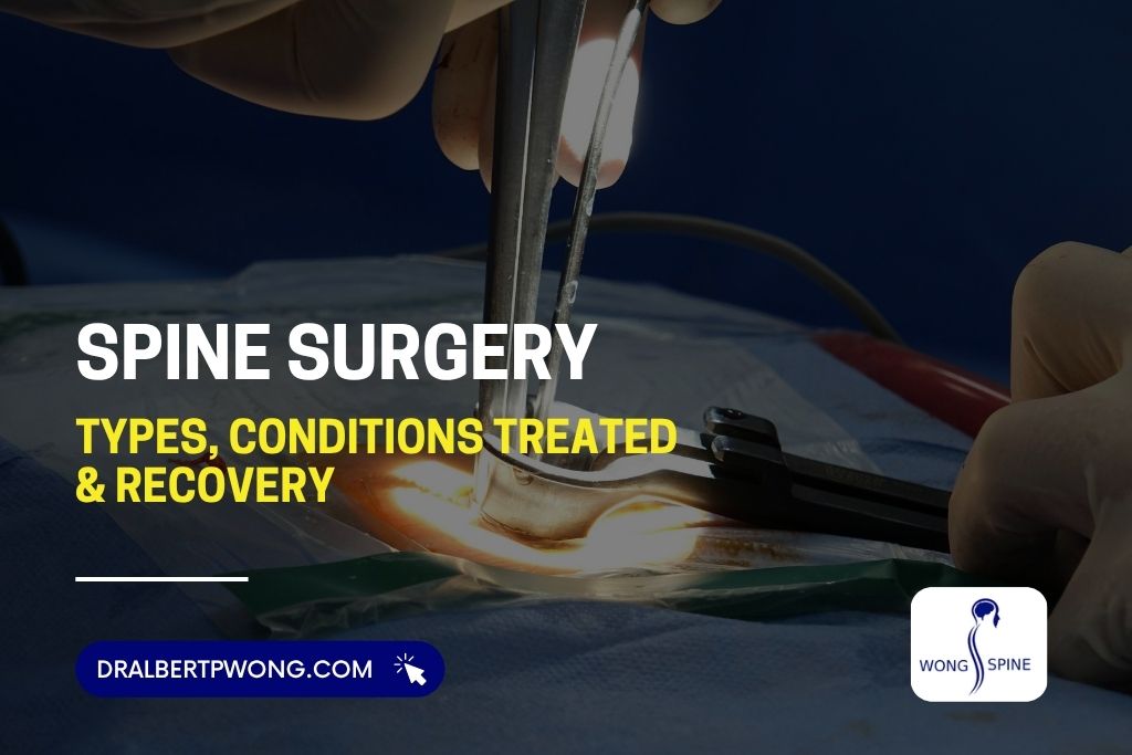 Spine Surgery: Types, Conditions Treated, Recovery