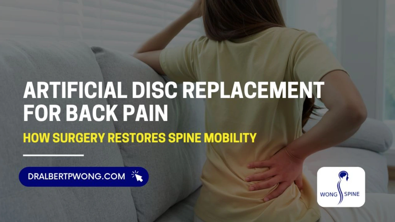 Artificial Disc Replacement for Back Pain