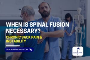 Spinal Fusion