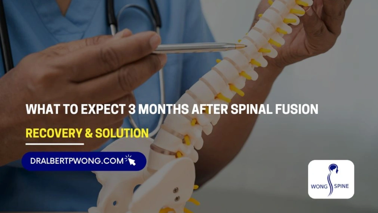 What to Expect 3 Months After Spinal Fusion