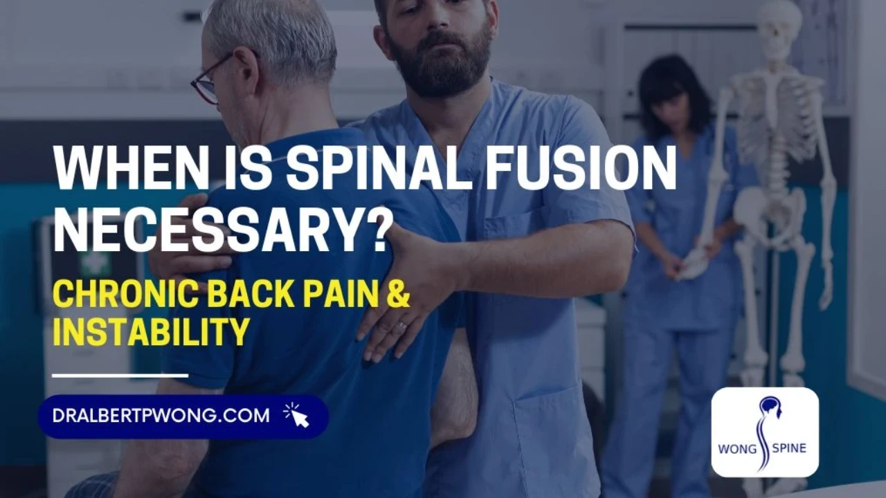 when is spinal fusion necessary