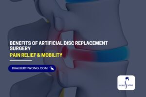 Benefits of Artificial Disc Replacement Surgery