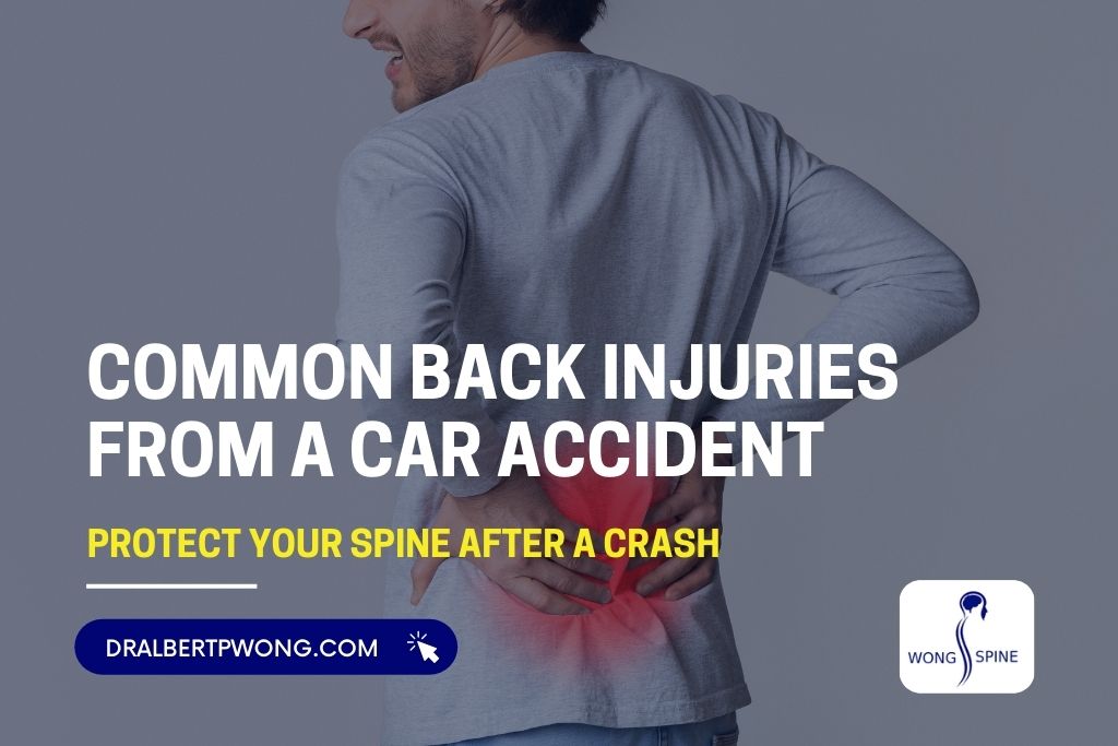 6 Common Back Injuries From a Car Accident
