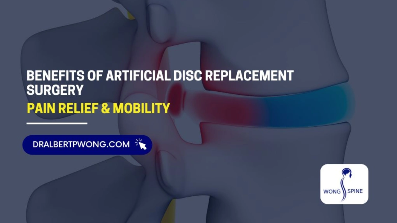 Artificial Disc Replacement Surgery