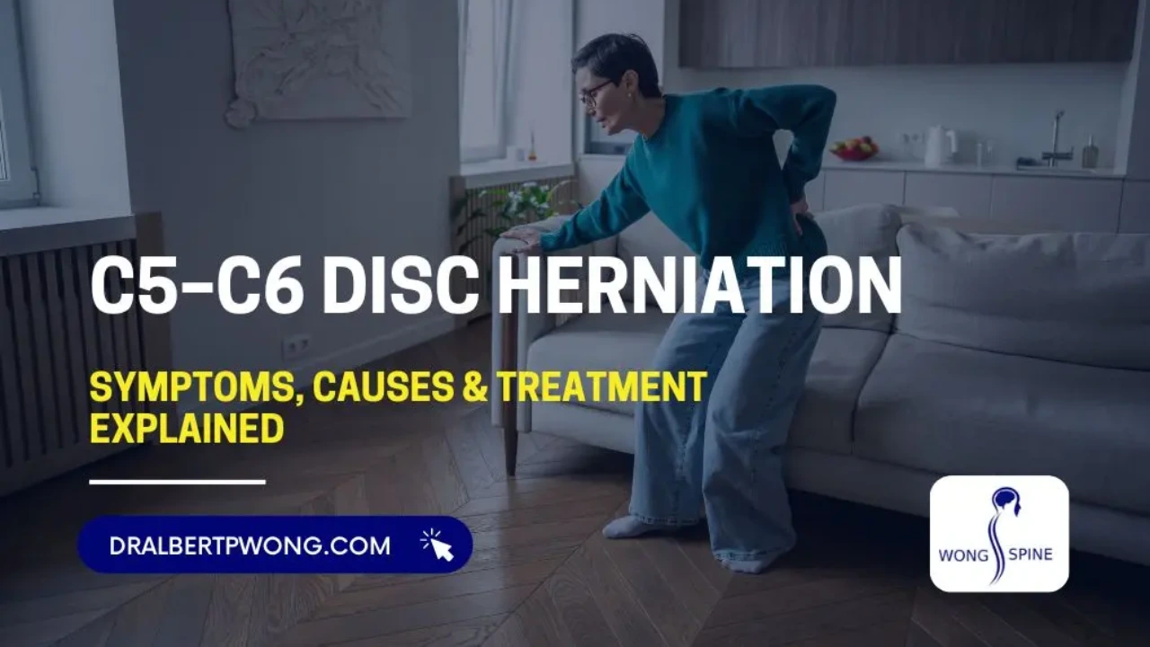 C5–C6 Disc Herniation