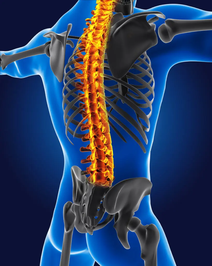 3D spine model highlighting spinal tumor locations and symptoms