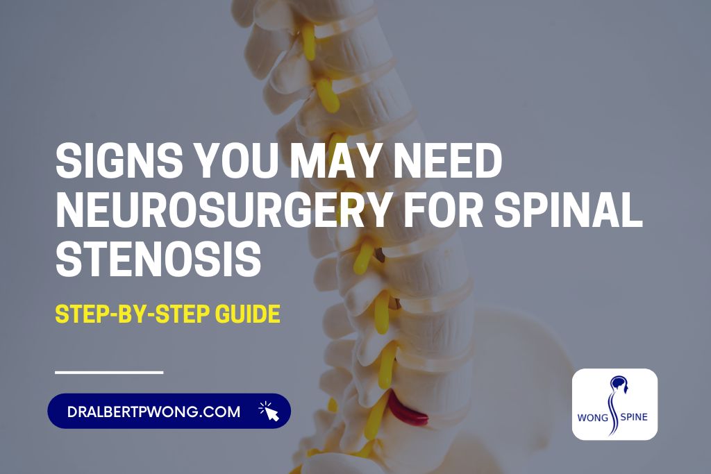 Signs You May Need Neurosurgery for Spinal Stenosis