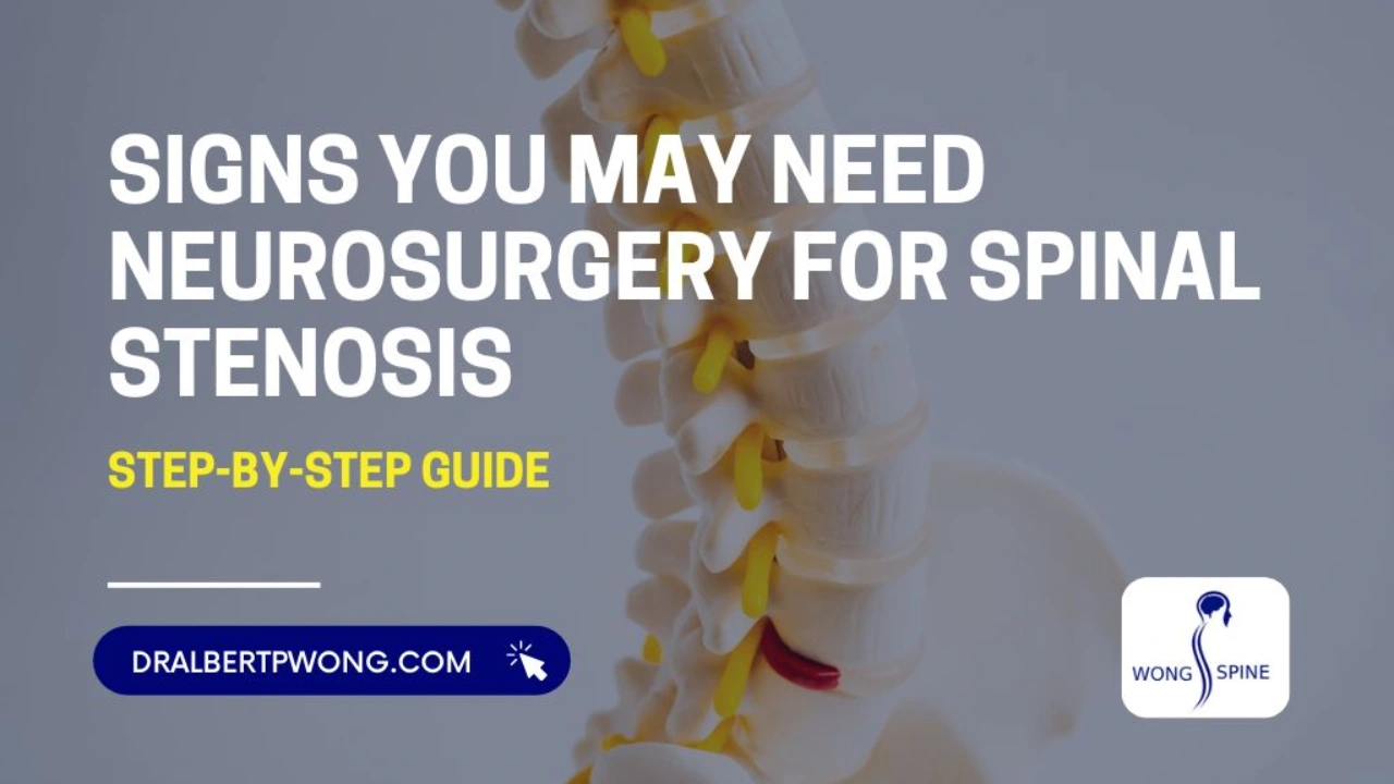 Signs You May Need Neurosurgery for Spinal Stenosis