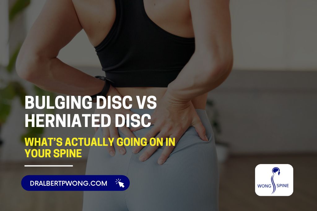 Bulging Disc vs Herniated Disc