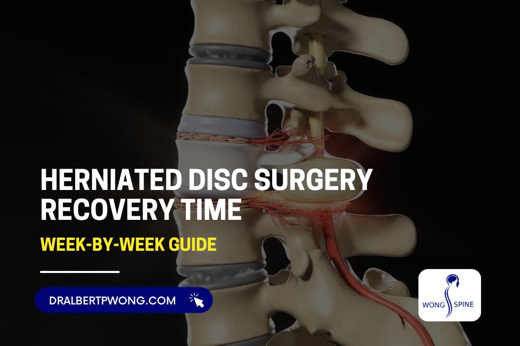 Herniated Disc Surgery Recovery Time