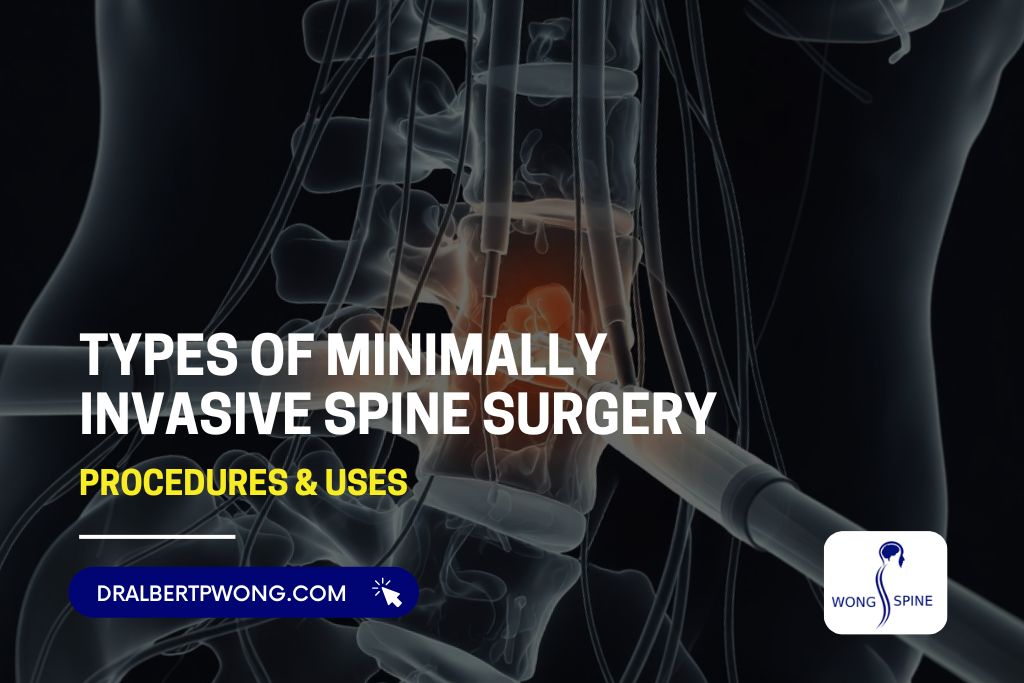 Types of Minimally Invasive Spine Surgery