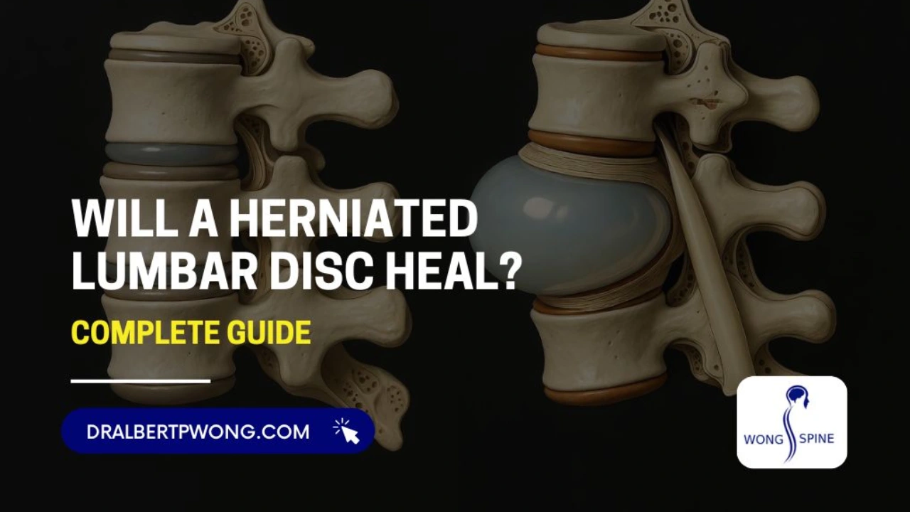 Will a Herniated Lumbar Disc Heal