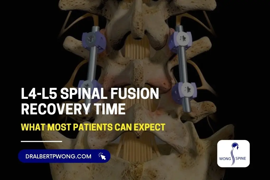 L4-L5 Spinal Fusion Recovery Time