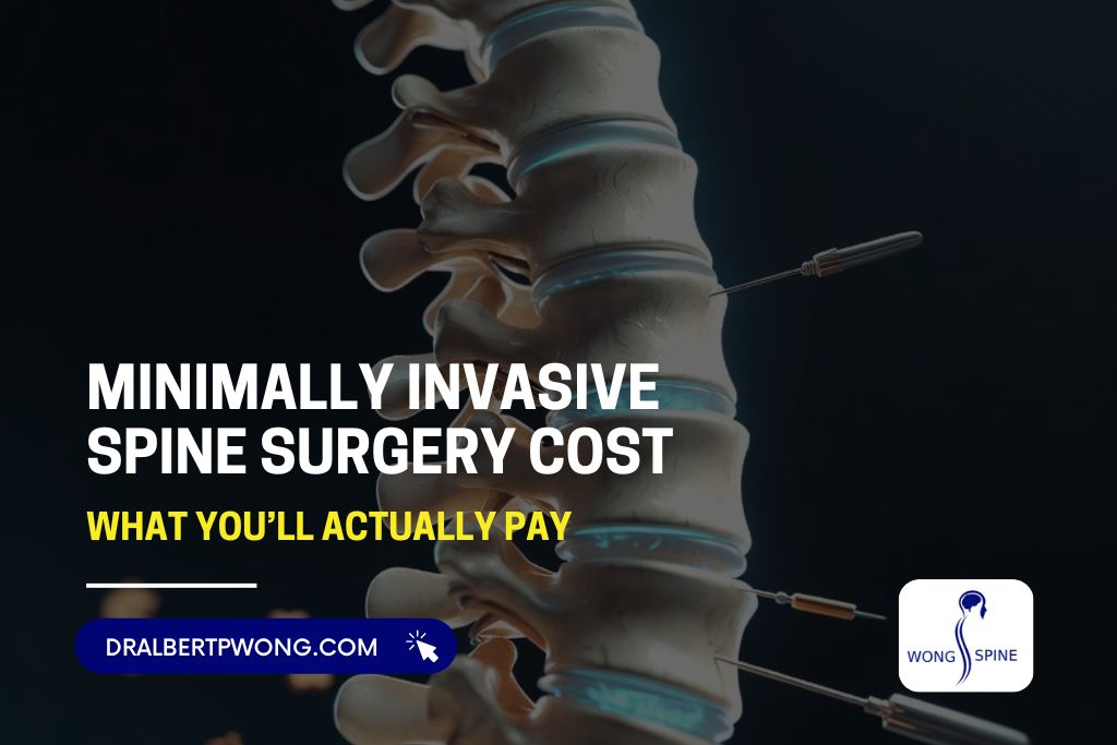 Minimally Invasive Spine Surgery Cost