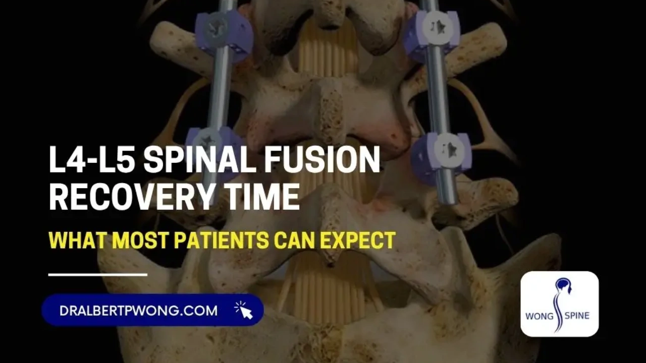 L4-L5 Spinal Fusion Recovery Time