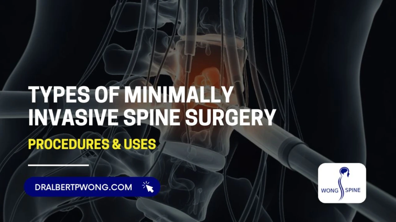 Types of Minimally Invasive Spine Surgery
