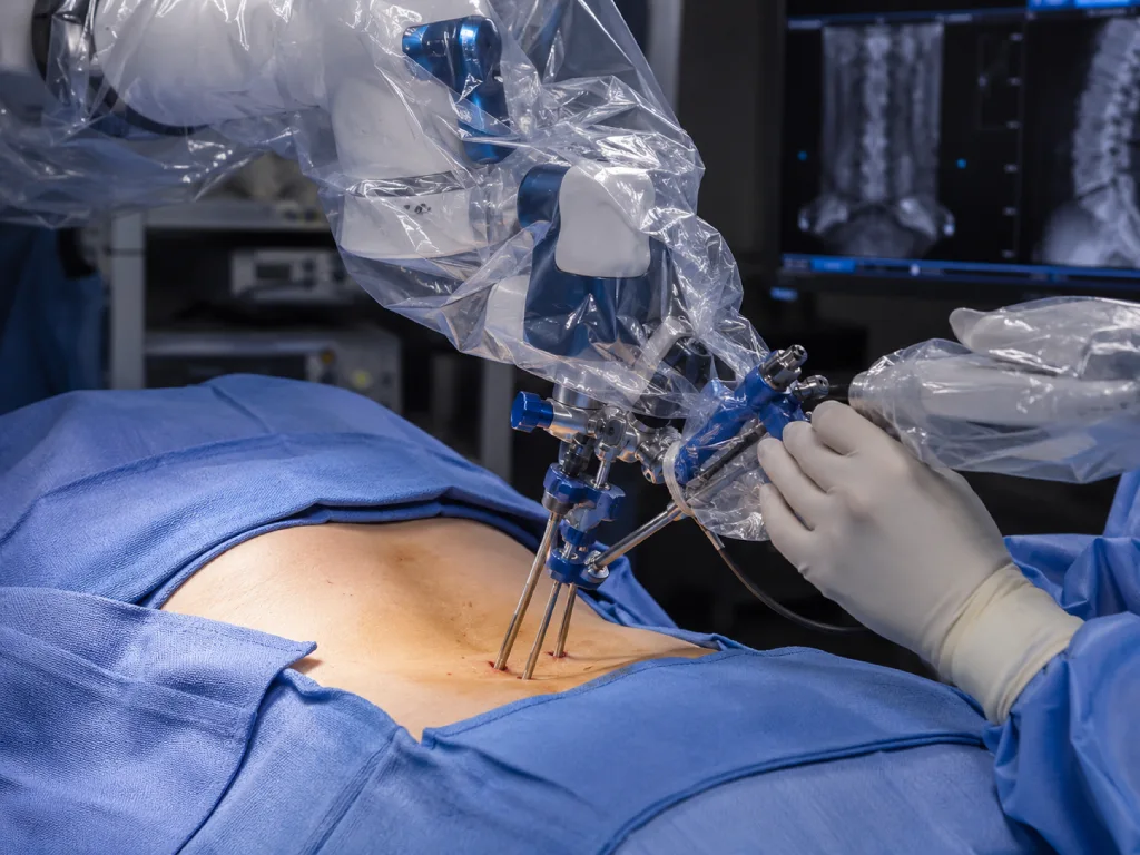 reduced risk of complications