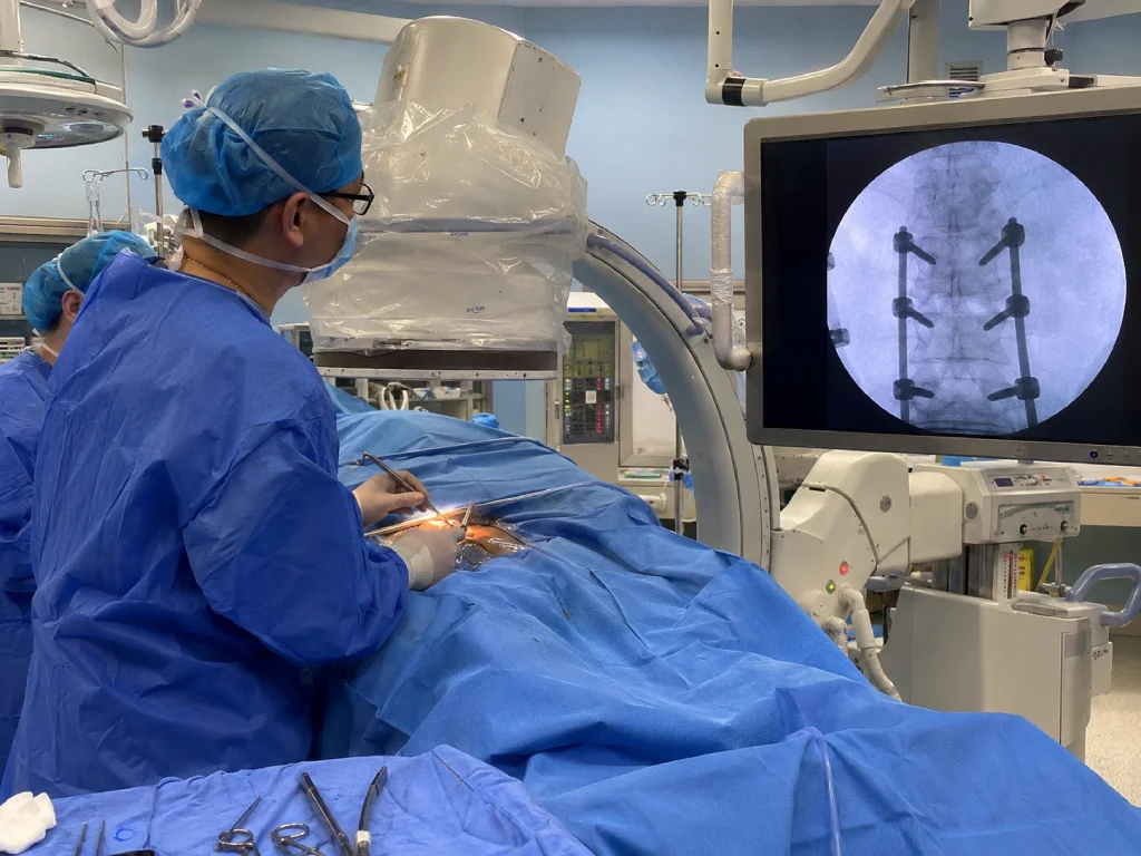 spinal fusion surgery