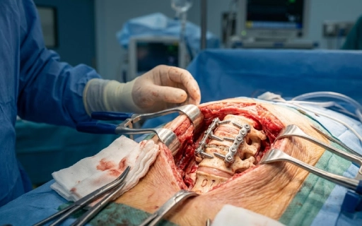 cervical spine fusion